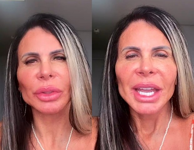  Após procedimentos, Gretchen surpreende ao mostrar seu novo bumbum