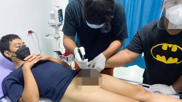  Pênis fica entalado em cano após tailandês fazer procedimento para aumentar o órgão