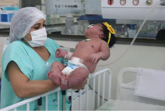  CRIANÇA DE 7 KG NASCE NO PARÁ E SURPREENDE MÉDICOS