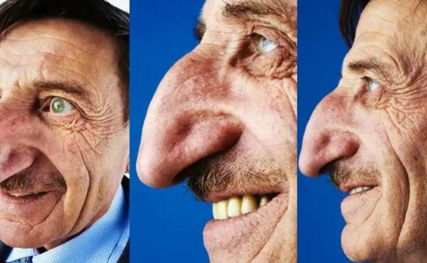  Turco de 72 anos tem maior nariz do mundo: “Fui abençoado”