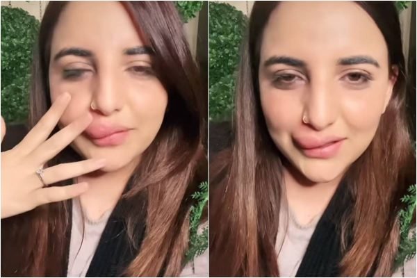  Mulher tem conta bloqueada e fica com preenchimento labial pela metade