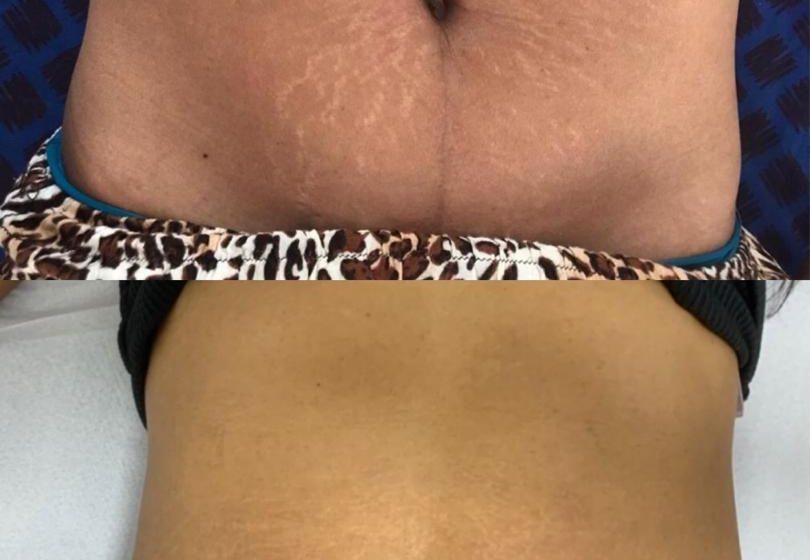  Camuflagem estética se torna aliada no resgate da autoestima