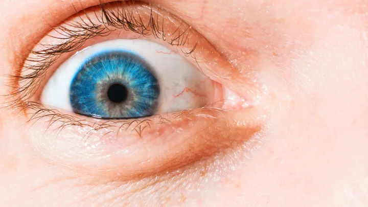  Brasileiro entra para o Guinness por recorde de olhos mais esbugalhados do mundo