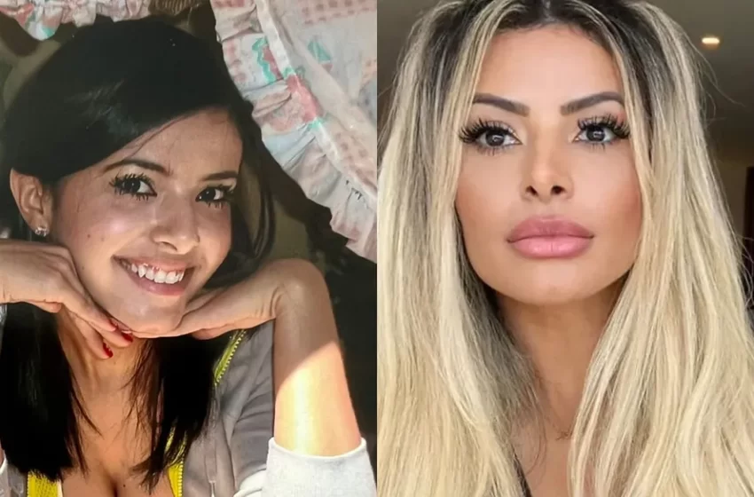  Influencer eleita ‘mulher perfeita’ admite gasto de quase R$ 300 mil em plásticas