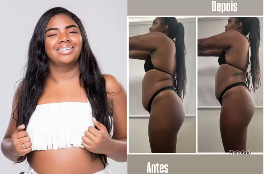  Irmã do ex-BBB Davi, Raquel Brito mostra antes e depois de procedimento e vira piada na web