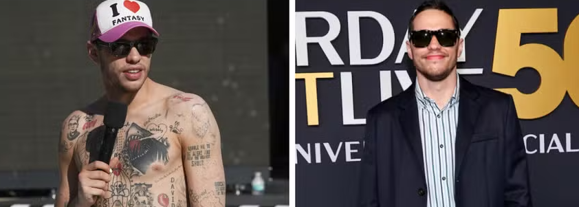  Ator ex de Kim Kardashian e Ariana Grande detalha processo doloroso e caríssimo para apagar suas tatuagens